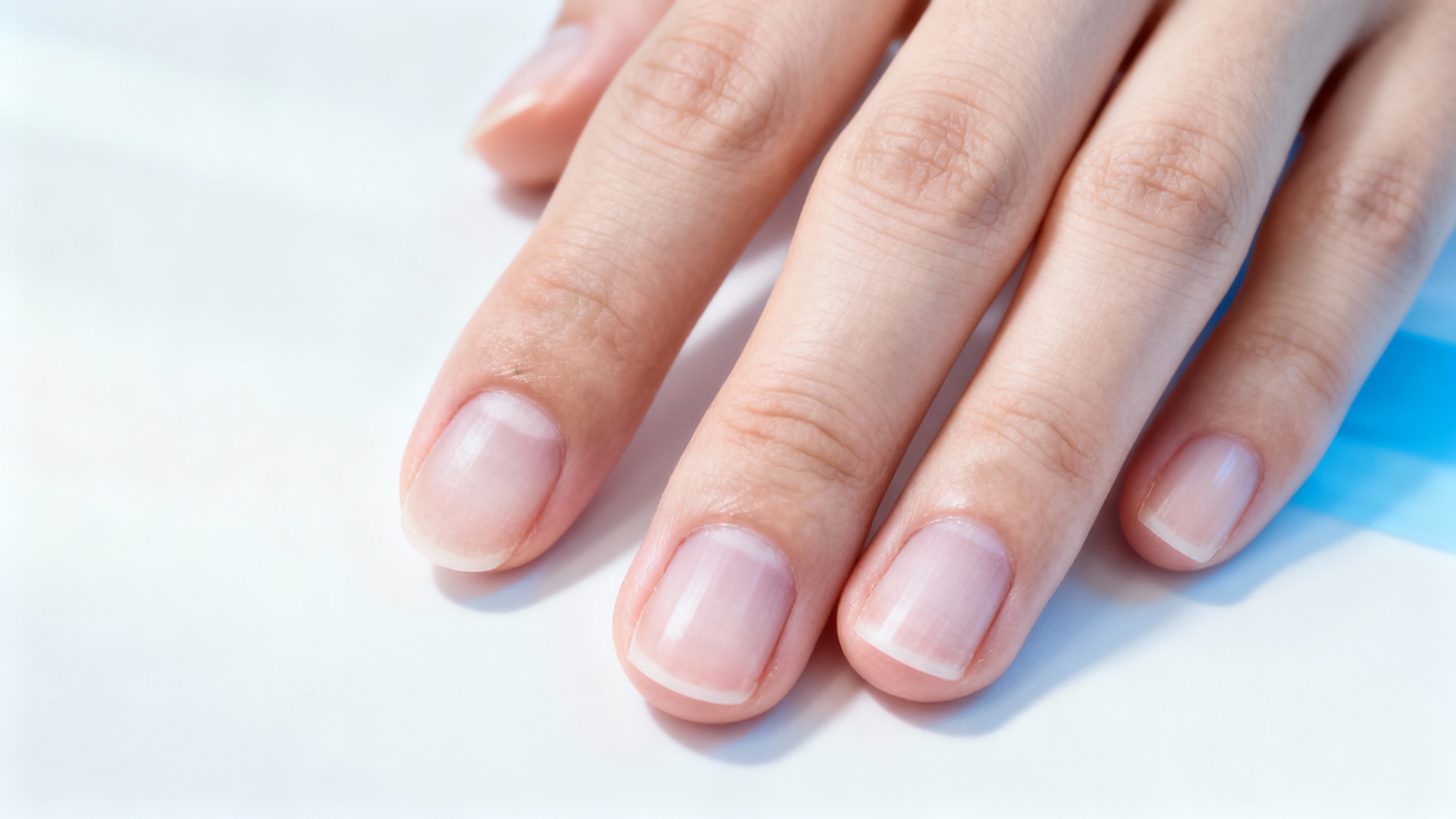 Featured image for The Causes of Tinea Unguium – And How To Prevent Them